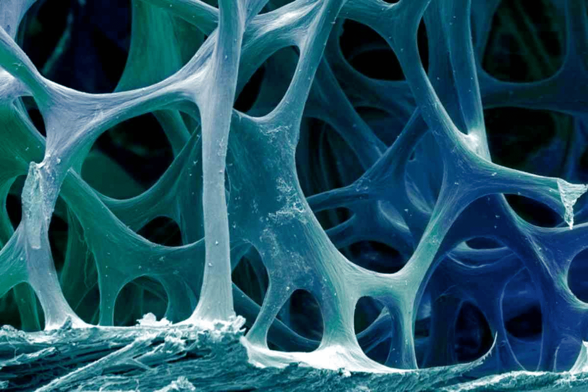 Insightful Complete Guide To Bisphosphonate Therapy