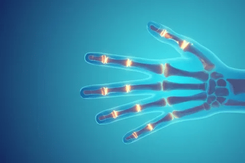 Insightful Methods For Treating Rheumatoid Arthritis Focus On