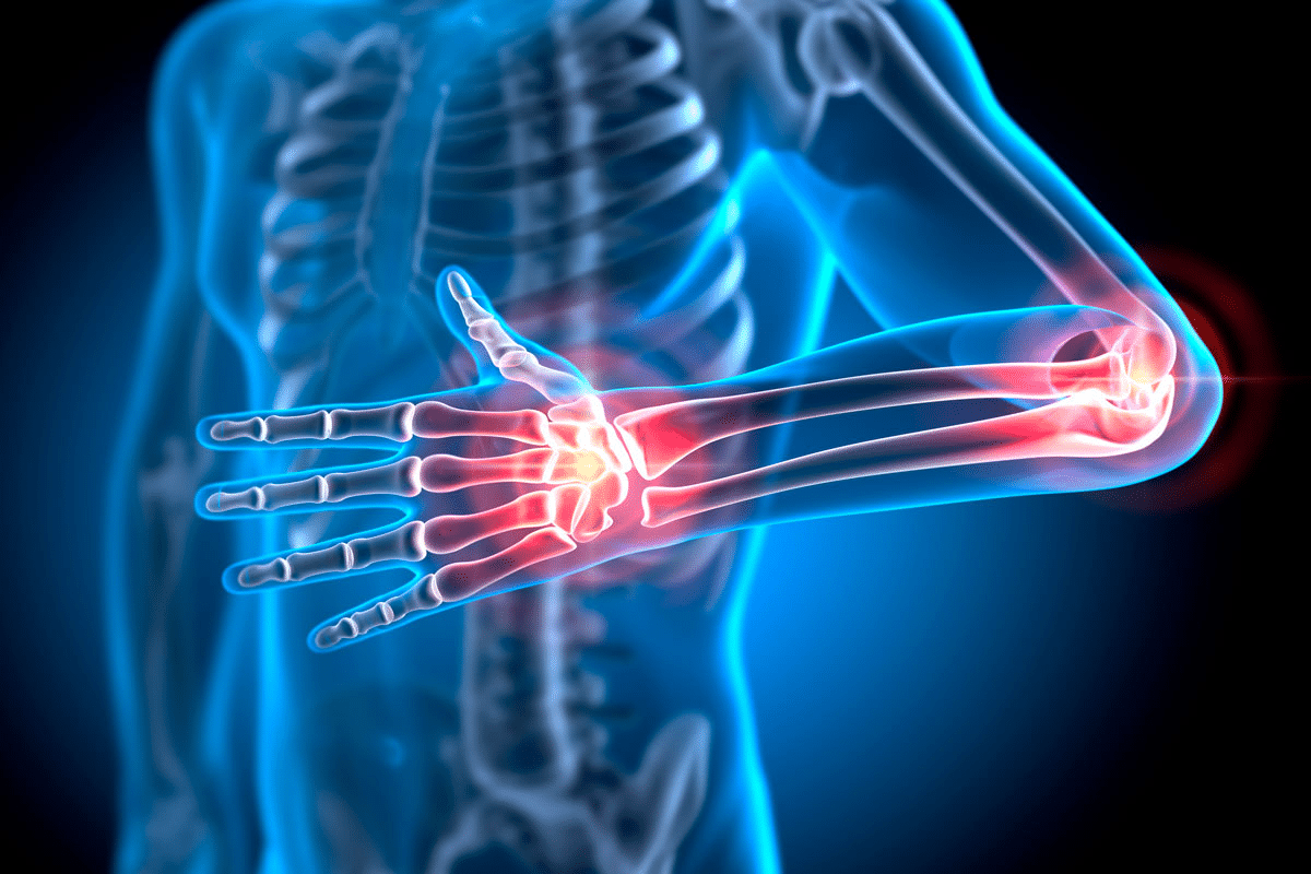 Profound 7 Best Alternative Therapies For Rheumatoid Arthritis