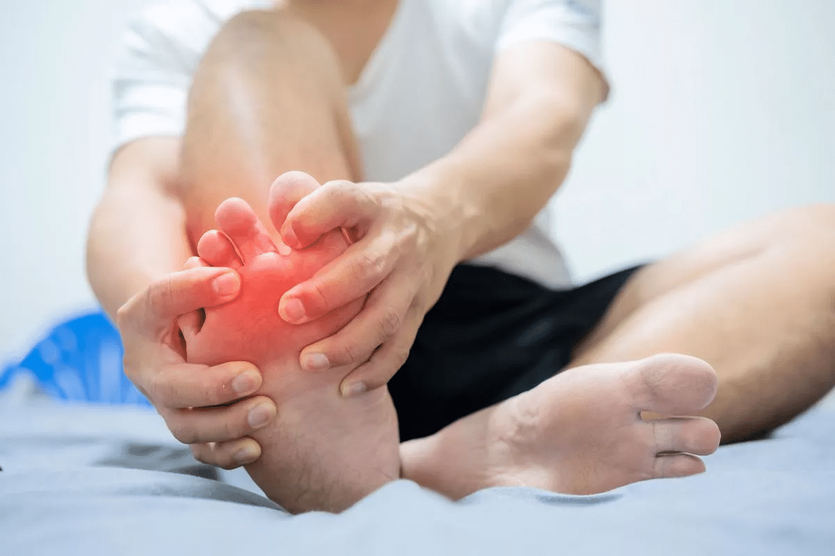 Profound Taking Allopurinol During A Gout Attack Rule