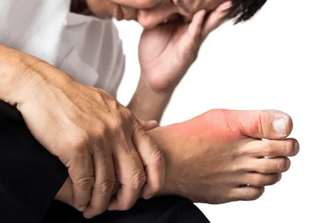 Sharp Allopurinol Dosage For Gout: Monitoring Guide