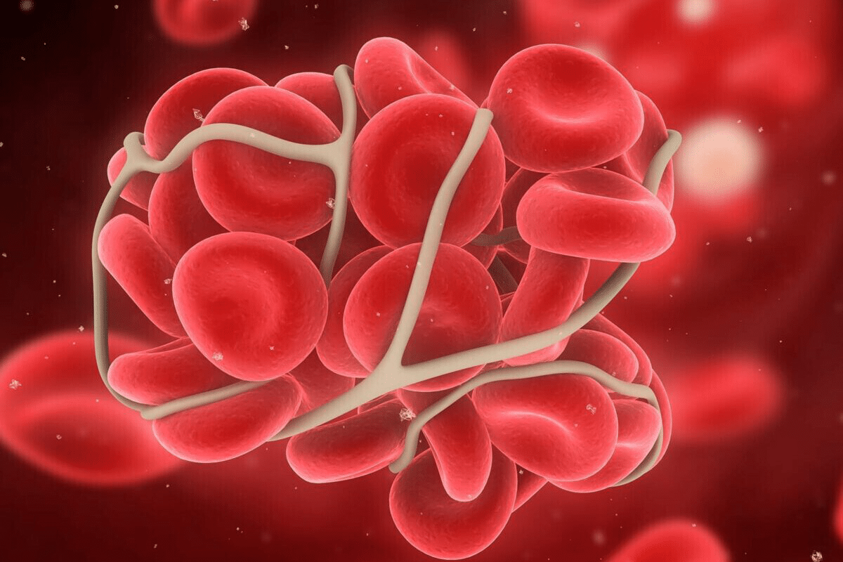 Key Lupus Root Cause & Common Triggers Explained