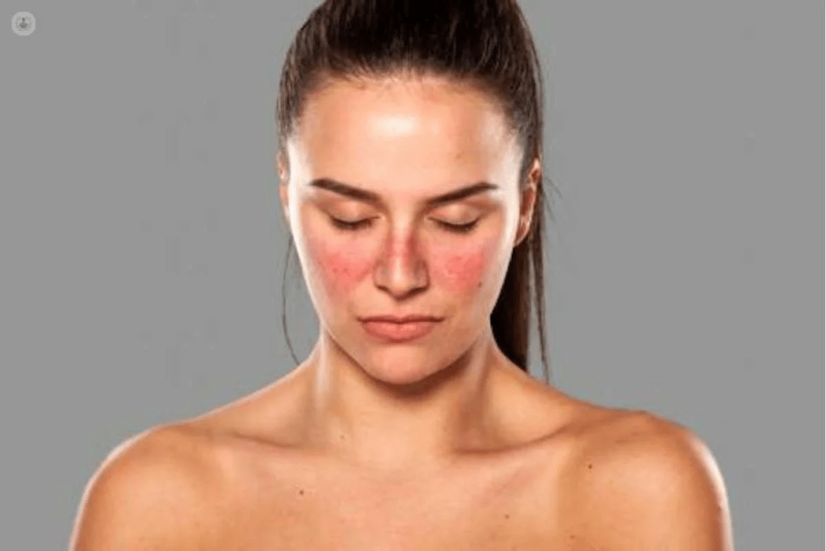 Crucial Are You Born With Lupus? Causes & Triggers