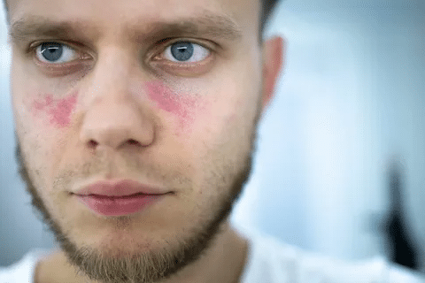 Crucial Are You Born With Lupus? Causes & Triggers