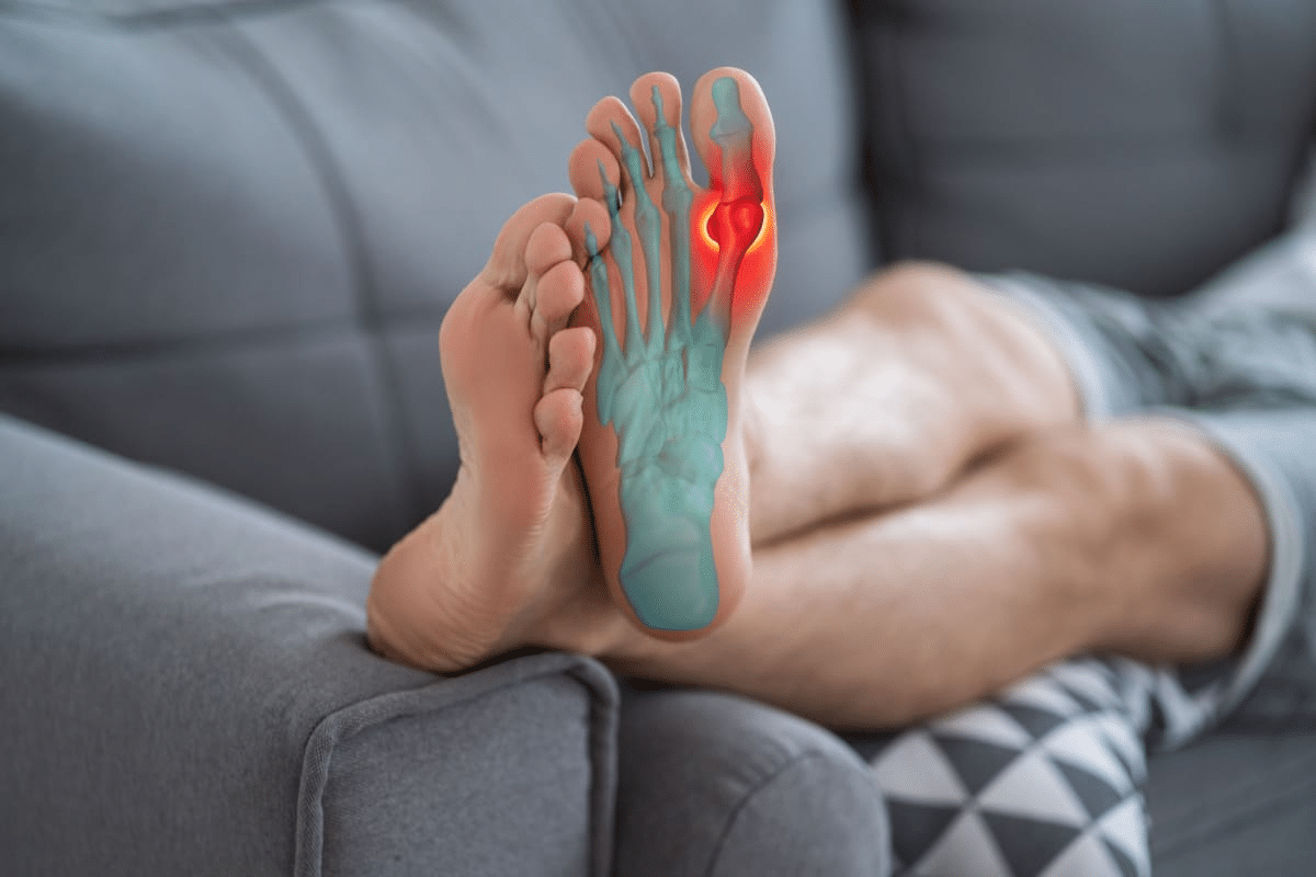 Key Naproxen Vs Ibuprofen For Gout Relief