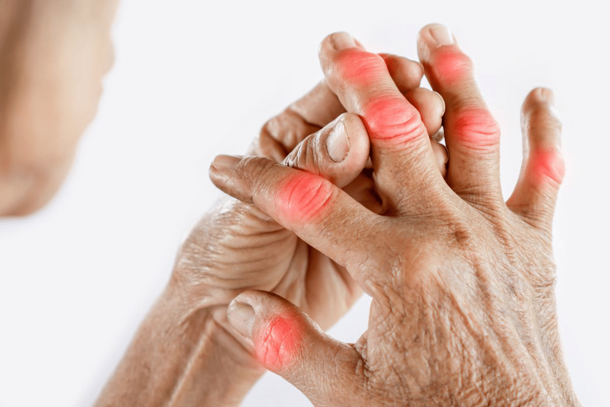 Ultimate 7 Best Medications Used For Gout