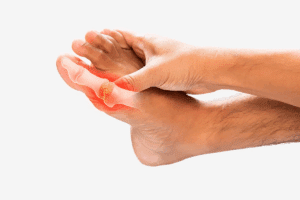 Ultimate 7 Best Medications Used For Gout