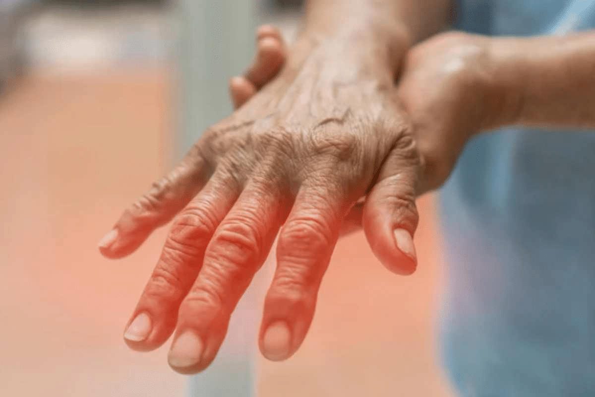 Amazing How To Relieve Hand Stiffness And Pain Quickly