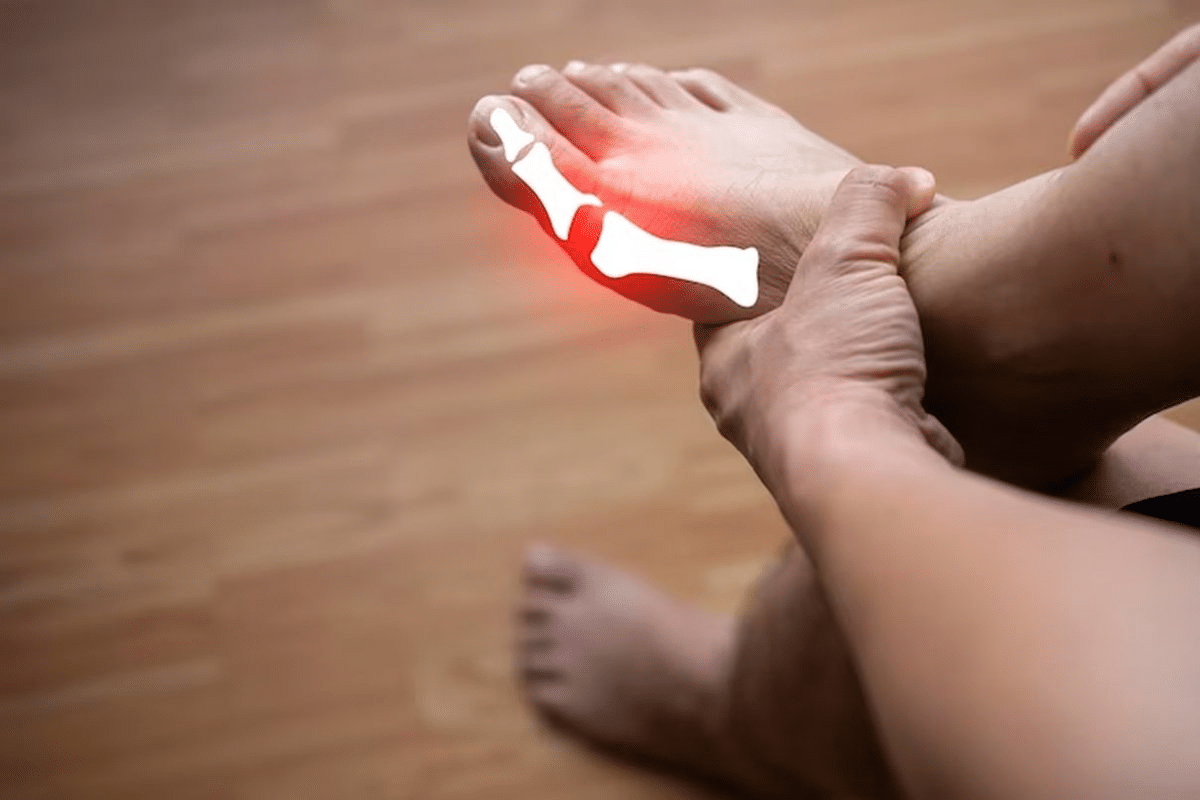 Amazing Prednisolone For Gout NICE Dosage Guide 2 Amazing Prednisolone For Gout NICE Dosage Guide