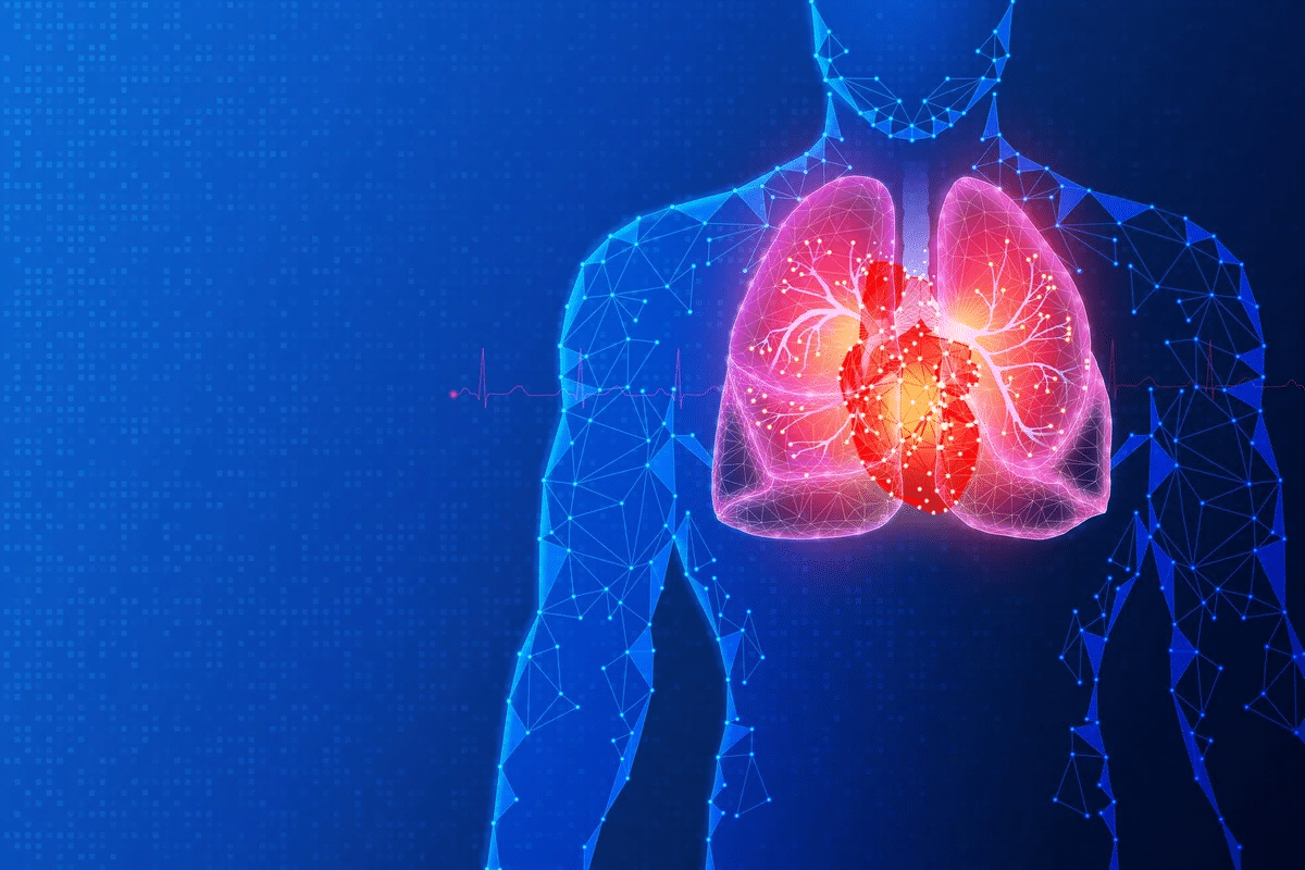 Profound 4 Different Forms Of Pneumonia Explained