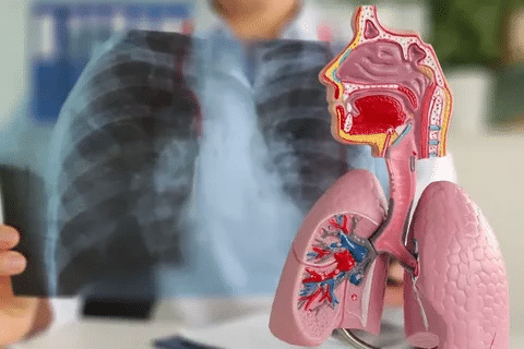 word image 240256 3 LIV Hospital