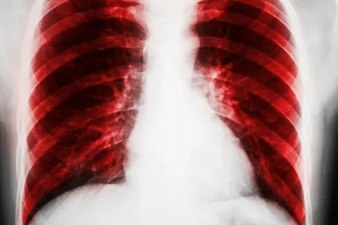 word image 240256 2 LIV Hospital