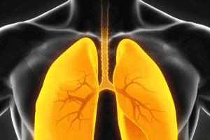 Valuable 5 Key Points On CAP Disease Definition & Causes