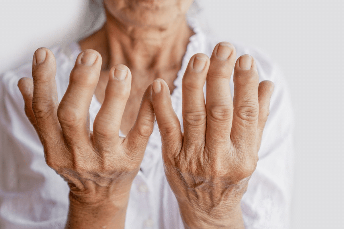 Insightful Signs Of Early Arthritis In Hands Treatment Guide