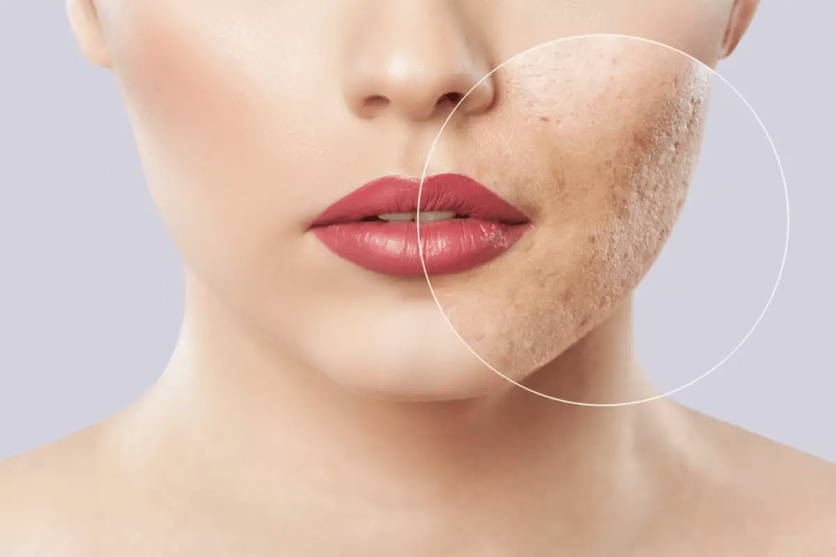 Amazing 5 Best Anti Inflammatory Ointment Options