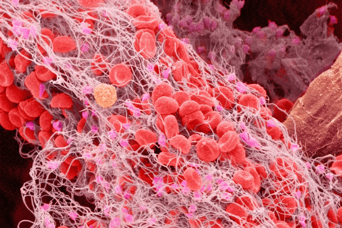 Guide 5 Signs When Why Does My Veins Hurt In My Arms?