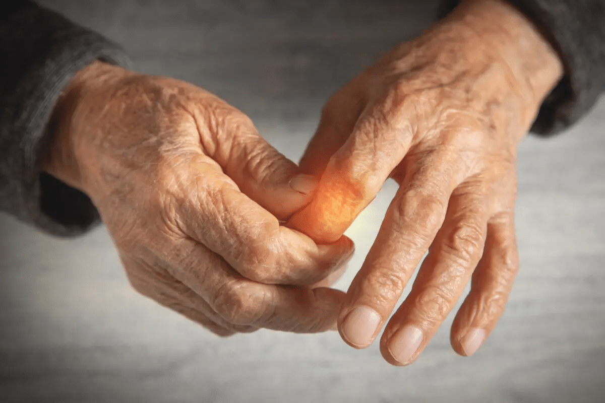 Crucial 7 Key Steps: How To Prevent RA