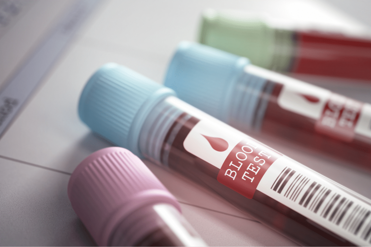 Ultimate What Does Antineutrophil Cytoplasmic Antibody Positive Mean?