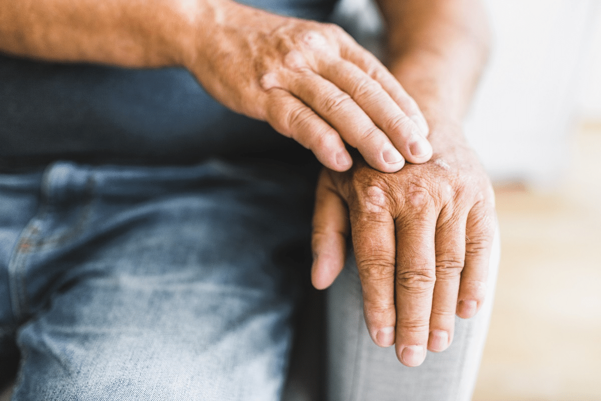 Valuable Define Arthrosis: Meaning & Treatment Options