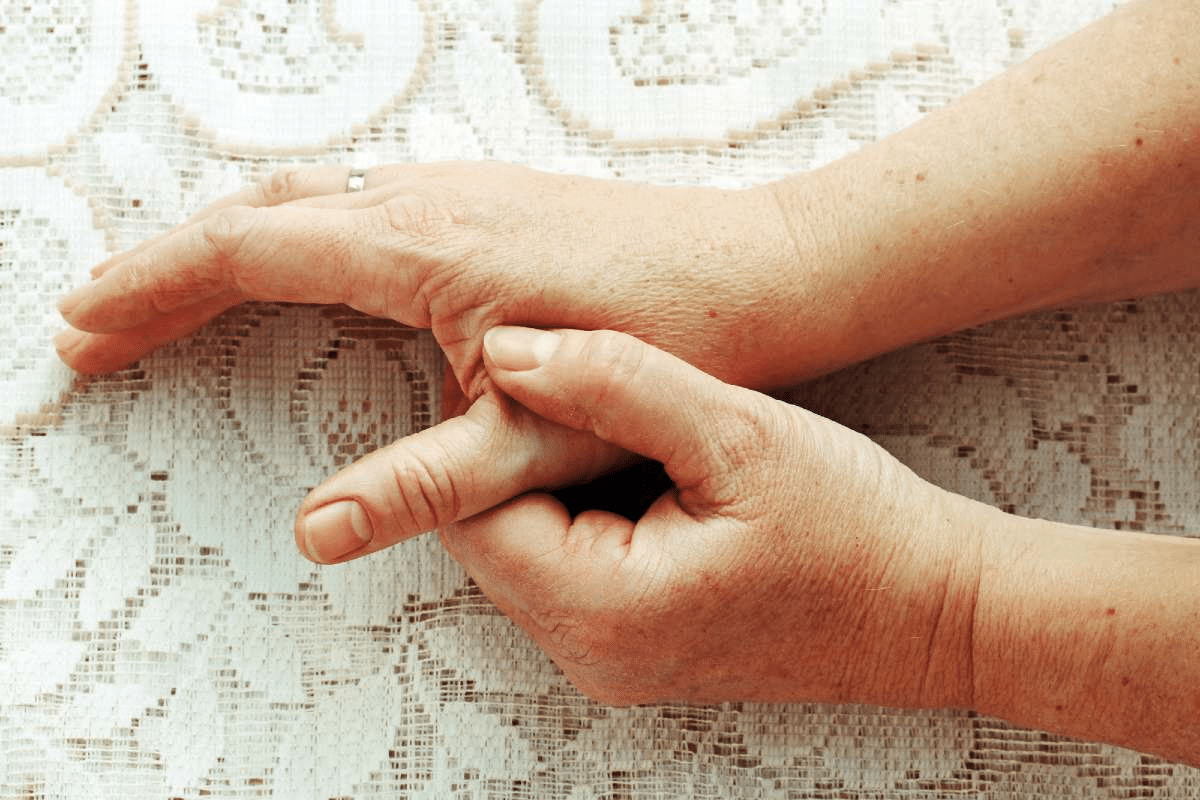 Key Therapy For Thumb Arthritis: Step-by-Step Exercises