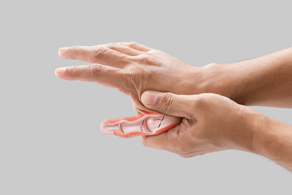 Guide Thumb Exercises For Arthritis Pain Relief Guide