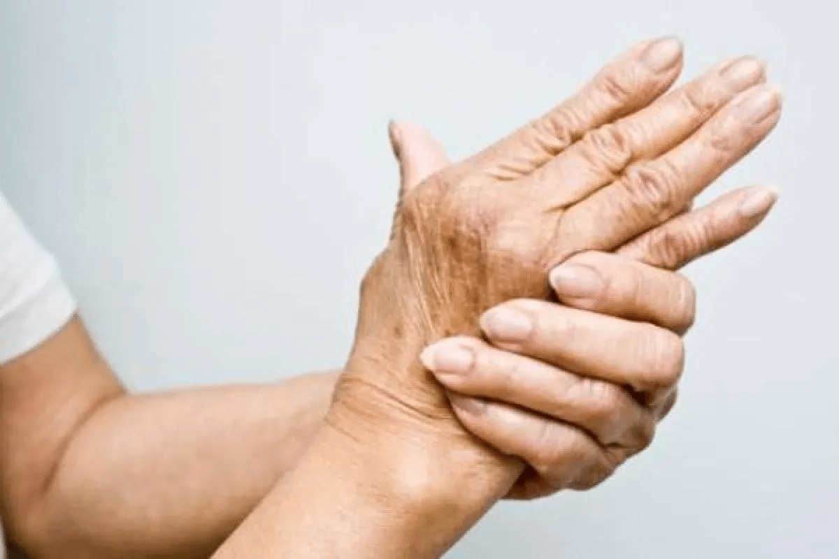 Key Causes Of Arthritis Flare Up & Prevention 1 Key Causes Of Arthritis Flare Up & Prevention