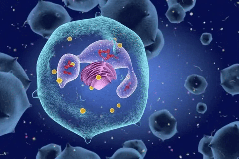 Guide ANCA Positive Vasculitis: Diagnosis & Management