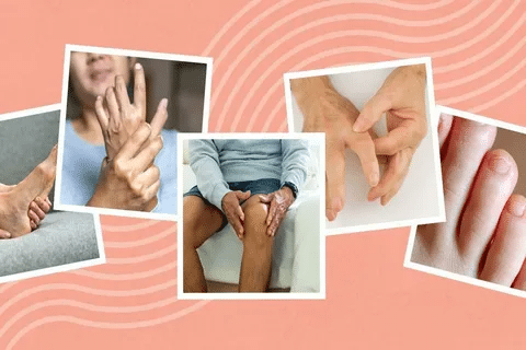 Fascinating Is RA Disease Progression Inevitable?