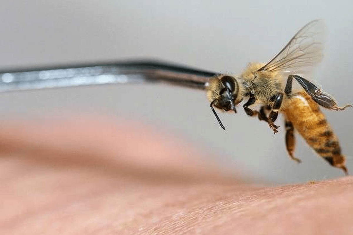 Crucial 5 Best Joint Cream Options For Pain Relief