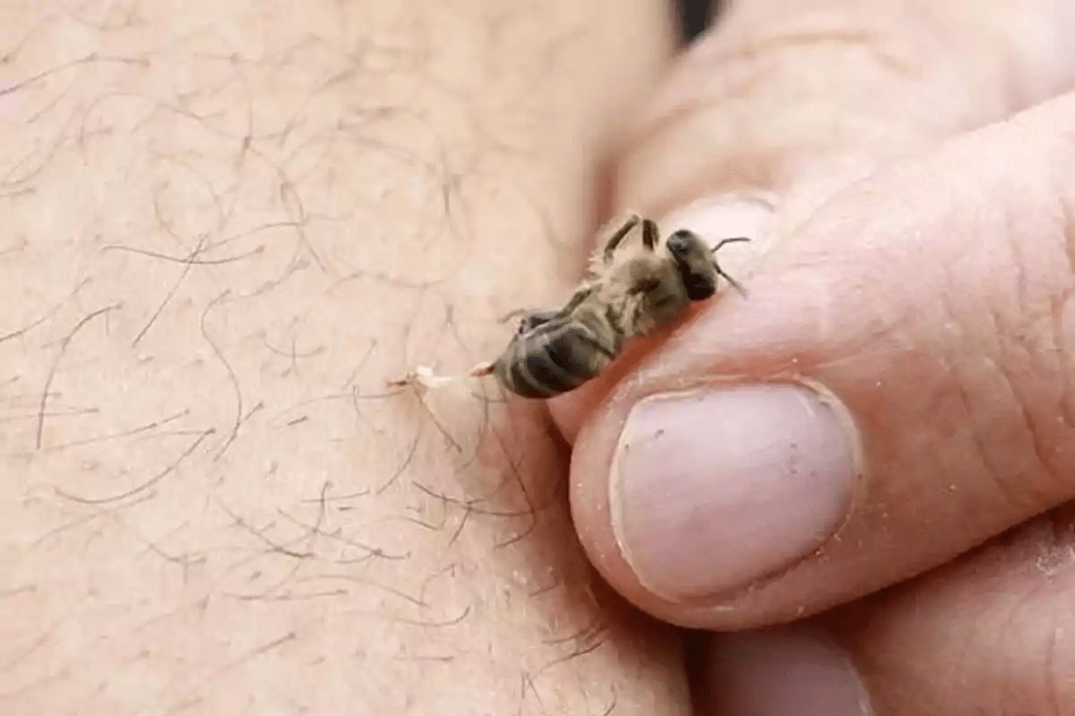 Crucial 5 Best Joint Cream Options For Pain Relief