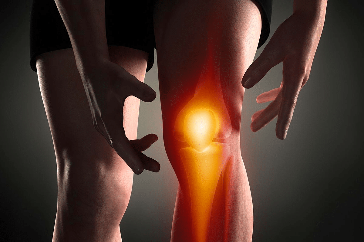 Guide List Of Foods That Cause Joint Pain & Inflammation