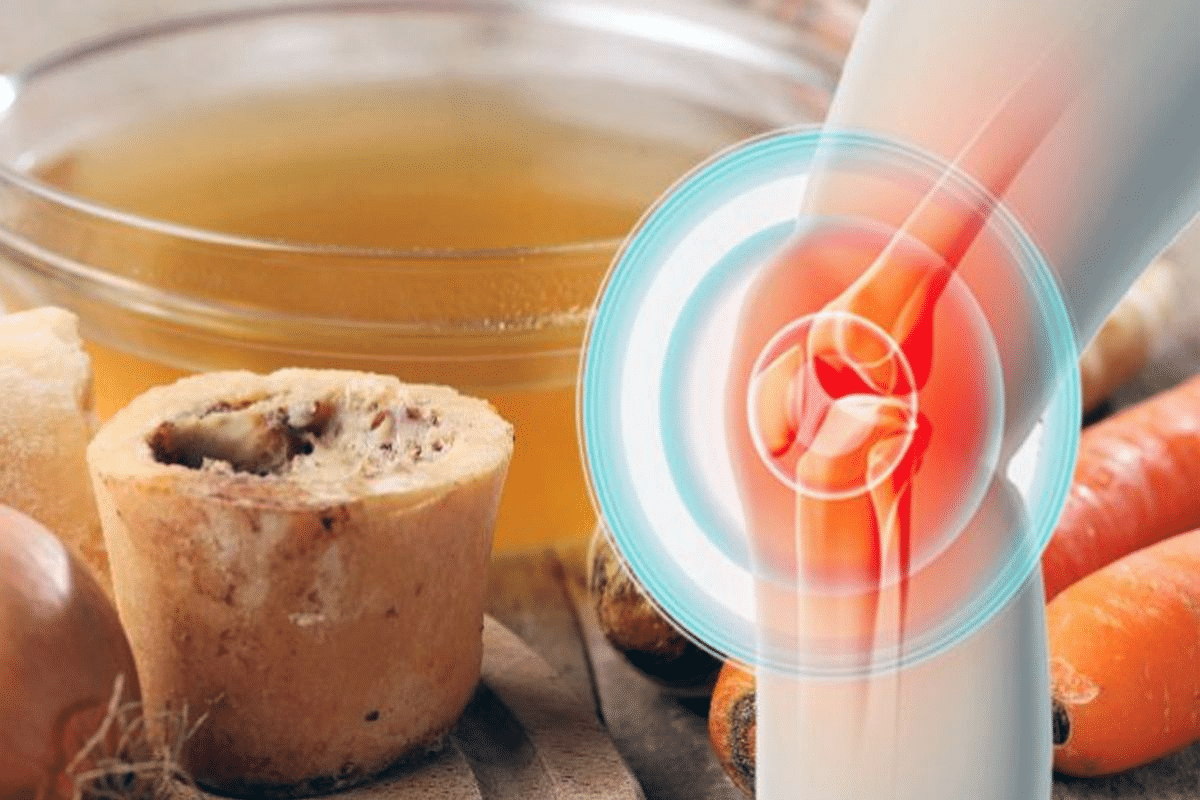 Guide List Of Foods That Cause Joint Pain & Inflammation