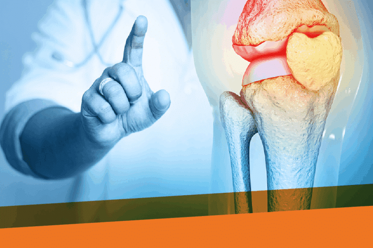 Simple Understand Brittle Bones (Osteogenesis Imperfecta)