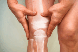 Key Bone On Bone Pain & Arthritis Management