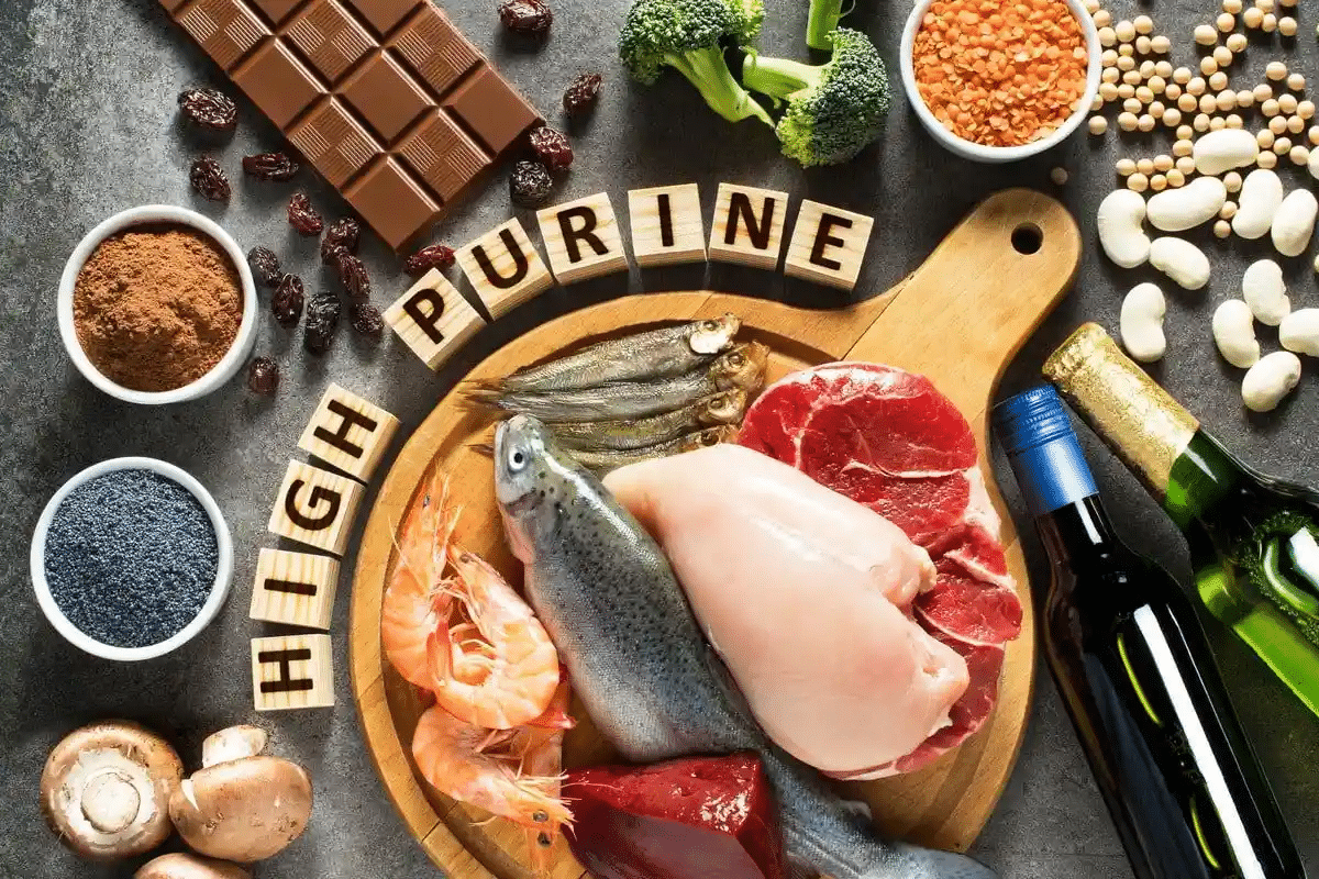 Amazing 10 Best Recommended Food For Arthritis