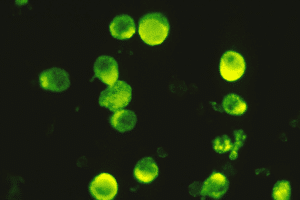 Complete What Is Nuclear Antibody Positive Meaning?b