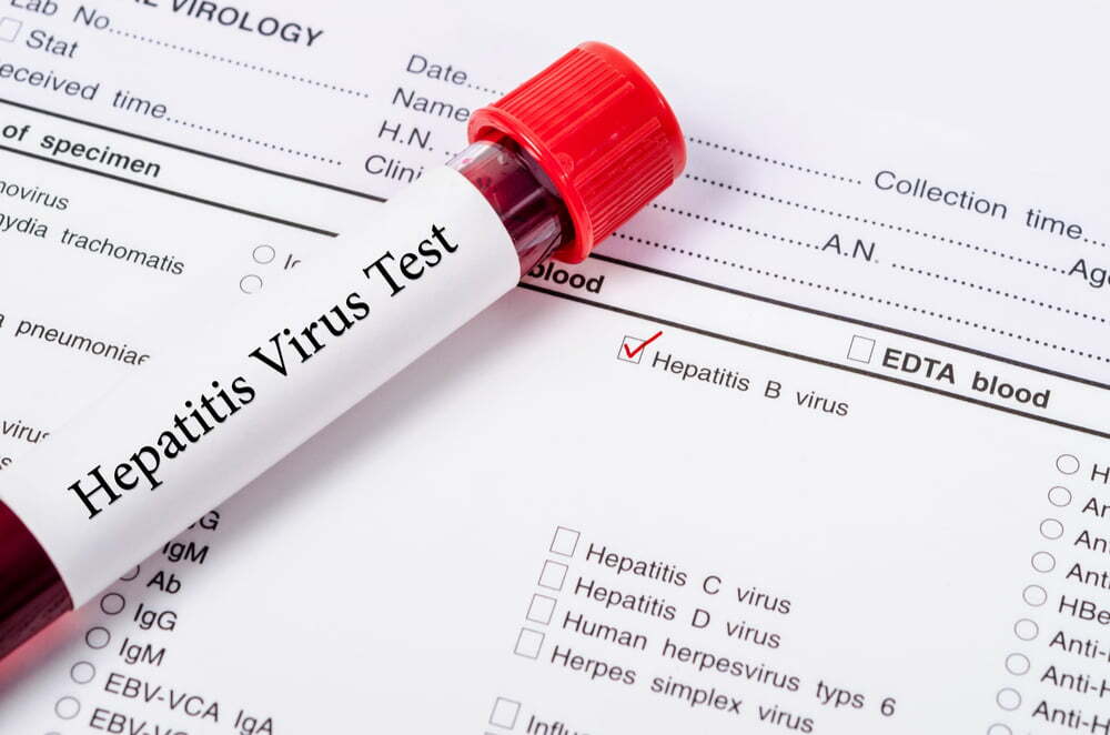 hepatitis testing day in orange county LIV Hospital