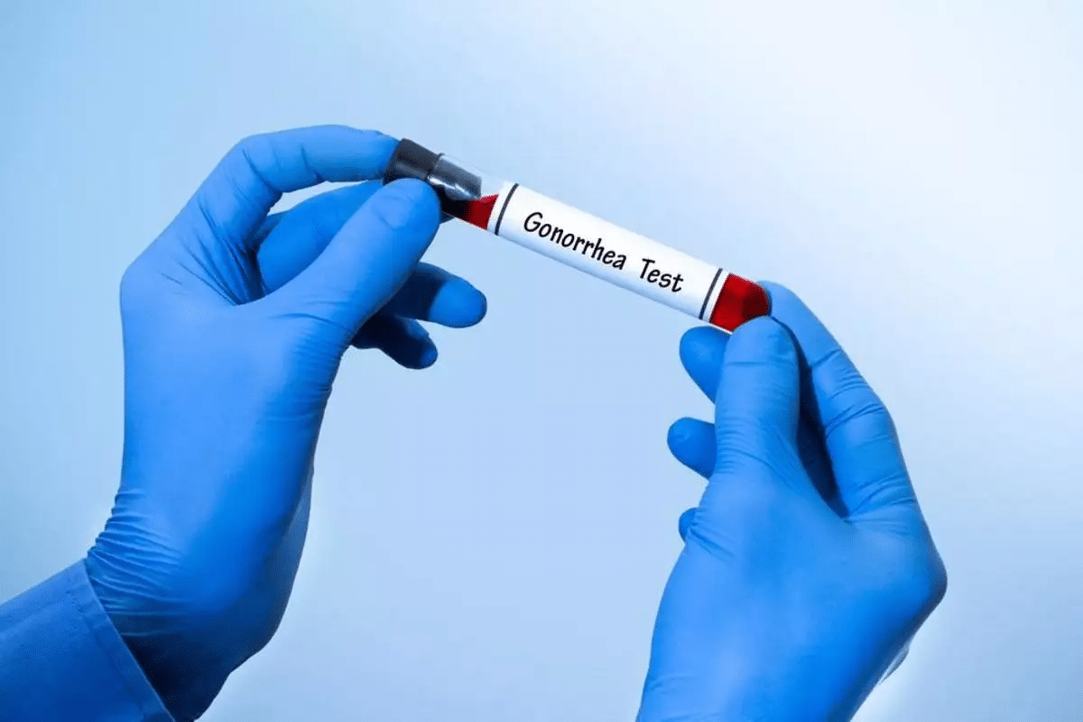 Fascinating Is There A Blood Test For Lupus? Guide 3 Fascinating Is There A Blood Test For Lupus? Guide