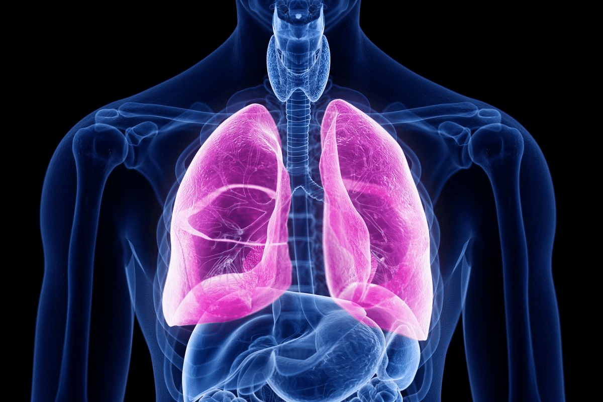 Amazing Asthma Obstructive Airway Disease Explained