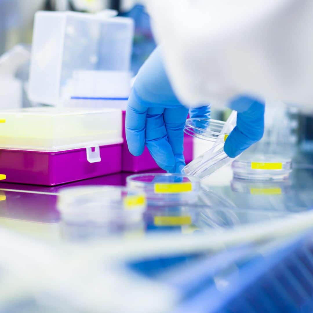 immunologia labor vizsgalat LIV Hospital