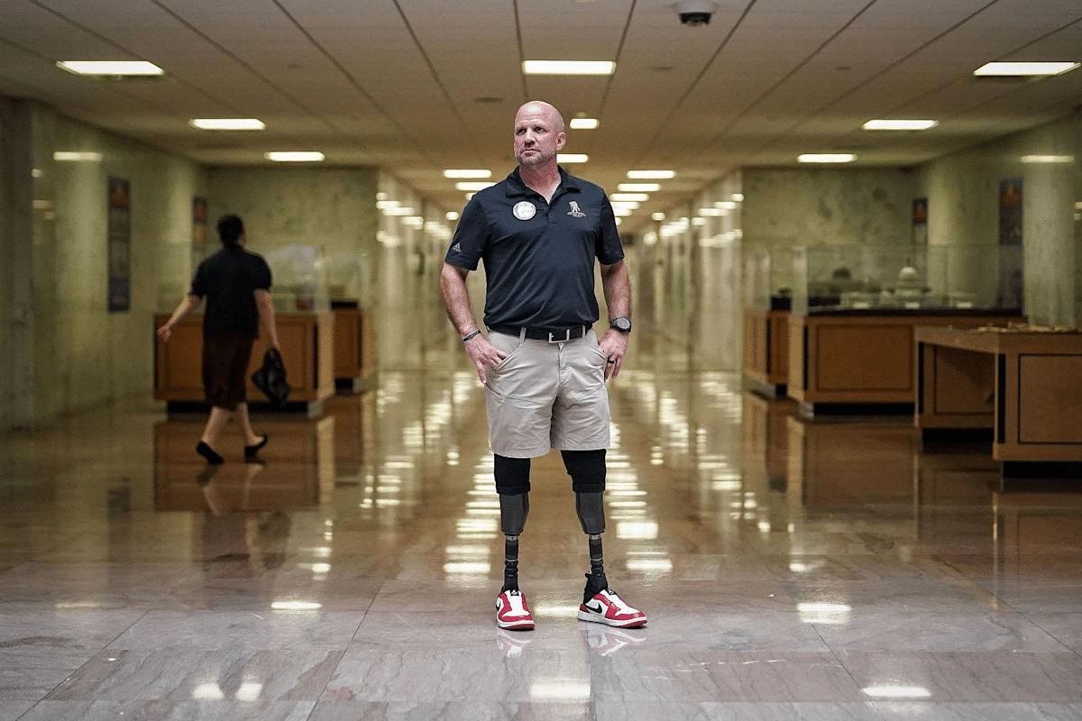 Complete Double Amputee Meaning: Definition Explained