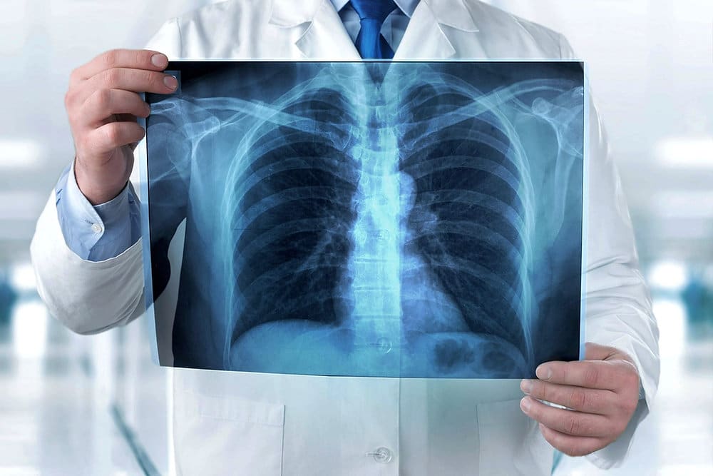 87a6fb 0fa46bf46d444d0c89bdc10aa73aa8e1mv2 LIV Hospital