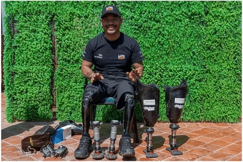 Complete Double Amputee Meaning: Definition Explained