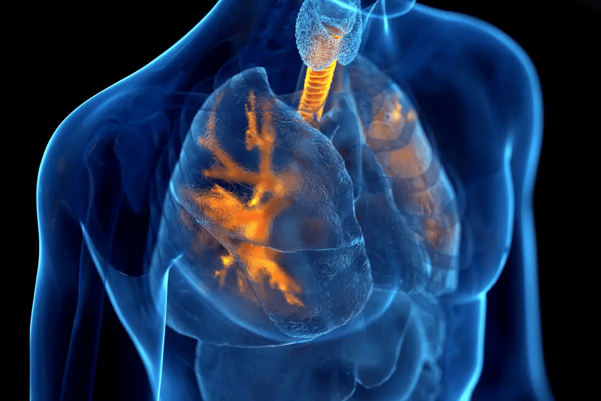 Simple Is Asthma Considered A COPD Disease Explained 1 Simple Is Asthma Considered A COPD Disease Explained