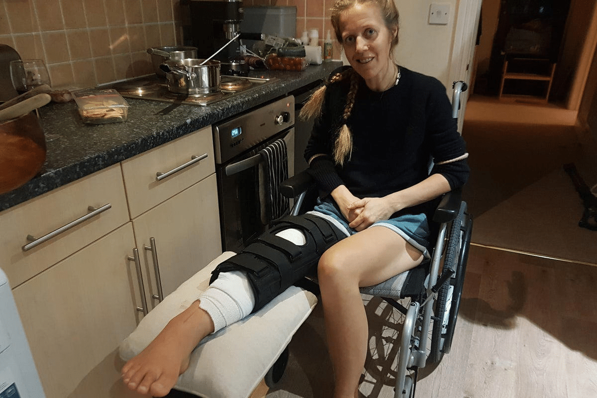 Essential Amputee Meaning: Definition And Explanation