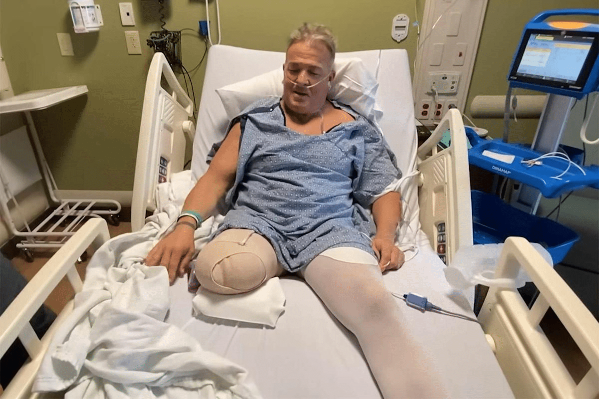 Sharp Amputation Care Plan For Impaired Mobility Guide 2 Sharp Amputation Care Plan For Impaired Mobility Guide