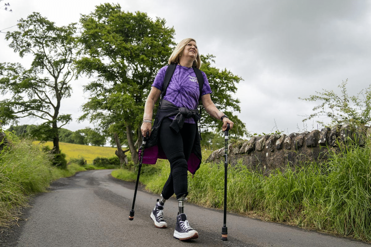 Key Find Amputation Support Resources & Coalition Help