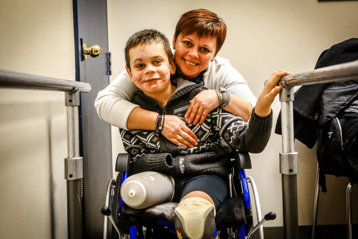 Amazing Find Amputee Support Resources & Coalition Services