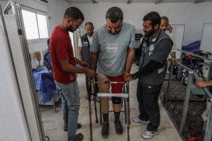 Profound Causes Of Missing Arm And Limbs At Birth Explained