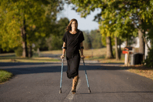 Essential Amputee Meaning: Definition And Explanation